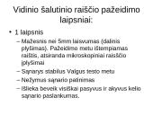 Kineziterapija po kelio sąnario raiščių pažeidimų 10 puslapis