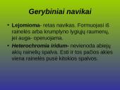Kraujagyslinio dangalo vystymosi anomalijos ir navikai 11 puslapis