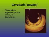 Kraujagyslinio dangalo vystymosi anomalijos ir navikai 12 puslapis