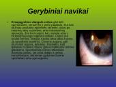 Kraujagyslinio dangalo vystymosi anomalijos ir navikai 13 puslapis