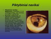 Kraujagyslinio dangalo vystymosi anomalijos ir navikai 14 puslapis