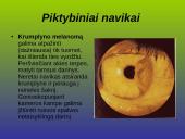 Kraujagyslinio dangalo vystymosi anomalijos ir navikai 15 puslapis