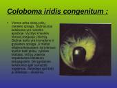 Kraujagyslinio dangalo vystymosi anomalijos ir navikai 5 puslapis