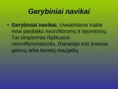 Kraujagyslinio dangalo vystymosi anomalijos ir navikai 10 puslapis