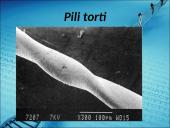 Menkės sindromas 12 puslapis