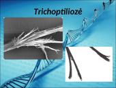 Menkės sindromas 14 puslapis