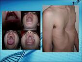 Menkės sindromas 16 puslapis