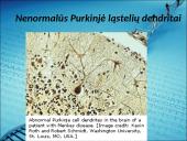 Menkės sindromas 19 puslapis