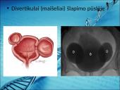 Menkės sindromas 20 puslapis