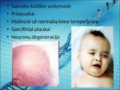 Menkės sindromas 3 puslapis