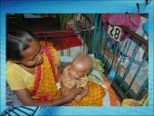 Menkės sindromas 4 puslapis