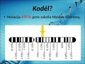 Menkės sindromas 5 puslapis