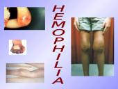 Procoagulation factors 20 puslapis