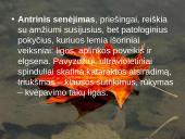 Suaugusio ir senstančio žmogaus raida (35-60) 17 puslapis
