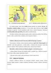 Sankabos valdymas 13 puslapis