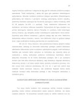 Pirmenybės ir garantijos nutraukiant darbo sutartį, reglamentavimo ir taikymo problemos 17 puslapis