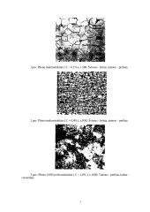 Atkaitintų anglinių plienų mikrostruktūros tyrimas 2 puslapis