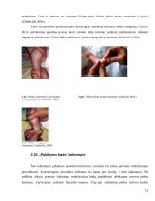 Įgimtos kūdikių šleivapėdystės etiopatogenezė, diagnostika ir gydymas Ponseti bei prancūzų funkciniu metodais 11 puslapis