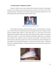 Įgimtos kūdikių šleivapėdystės etiopatogenezė, diagnostika ir gydymas Ponseti bei prancūzų funkciniu metodais 9 puslapis