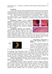 Bakteriniai toksinai 15 puslapis