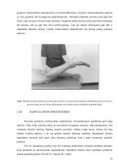 Miofascialinio atpalaidavimo taikymas koneziterapijoje 19 puslapis