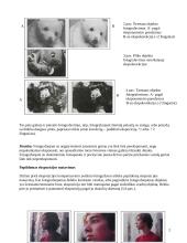 Tikslios ekspozicijos nustatymas 2 puslapis