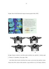 Nugaros skausmai, kurio dažniausia priežastis – tarpslankstelinio disko išvarža 13 puslapis