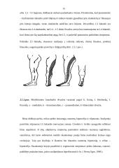 Nugaros skausmai, kurio dažniausia priežastis – tarpslankstelinio disko išvarža 15 puslapis