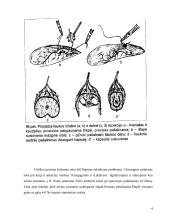Prostatos chirurginės ligos 5 puslapis