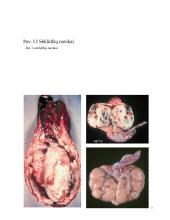 Prostatos chirurginės ligos 8 puslapis