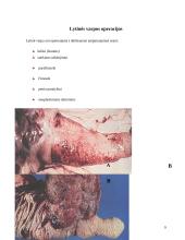 Prostatos chirurginės ligos 10 puslapis