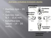 Krūminiai dantys 11 puslapis