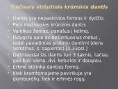 Krūminiai dantys 13 puslapis