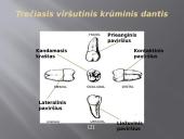 Krūminiai dantys 14 puslapis