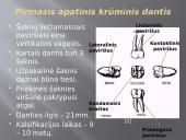 Krūminiai dantys 18 puslapis