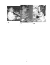 Fizinė terapija asmenims su Dauno sindromu 6 puslapis