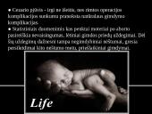 Ankstyvas paauglių nėštumas 10 puslapis