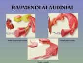 Žmogaus raumenys 3 puslapis