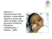 Hipervitaminozė 12 puslapis