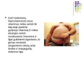 Hipervitaminozė 14 puslapis
