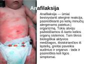 Vaikų alergija maistui 12 puslapis
