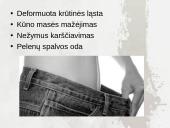 Kaip išvengti kvėpavimo sistemos ligų 8 puslapis