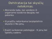 Neigiamoji vandens pusiausvyra. Formos, priežastys ir padariniai 3 puslapis