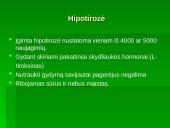 Visuotinė naujagimių patikra 14 puslapis