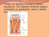 Danties minkštimas — pulpa 2 puslapis