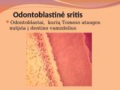 Danties minkštimas — pulpa 4 puslapis