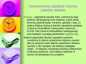 Gyvenamosios patalpos nuoma. Viskas ką reikia žinoti 9 puslapis