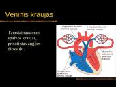 Kraujas. Skaidrės. 14 puslapis
