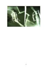 Traumos ir sveikata 17 puslapis