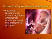 Fizinio krūvio įtaka nėštumo laikotarpiui 3 puslapis